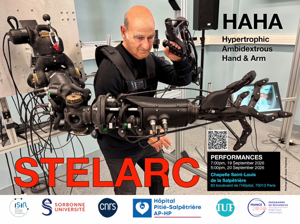 Stelarc – Hypertrophic Ambidextrous Hand and Arm | Sorbonne Université